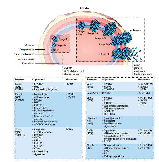 膀胱癌的病理和分子特征.png